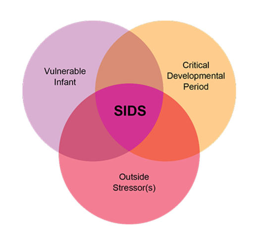 SIDS Triple Risk Model